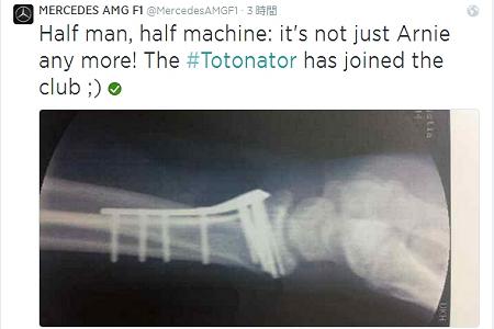 メルセデスAMGのボス、自転車事故で大けが