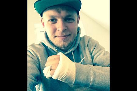 【マクラーレン・ホンダ】ケビン・マグヌッセンが左手を骨折