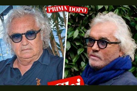 【整形前後の画像有り】ブリアトーレ65歳、別人に変身！