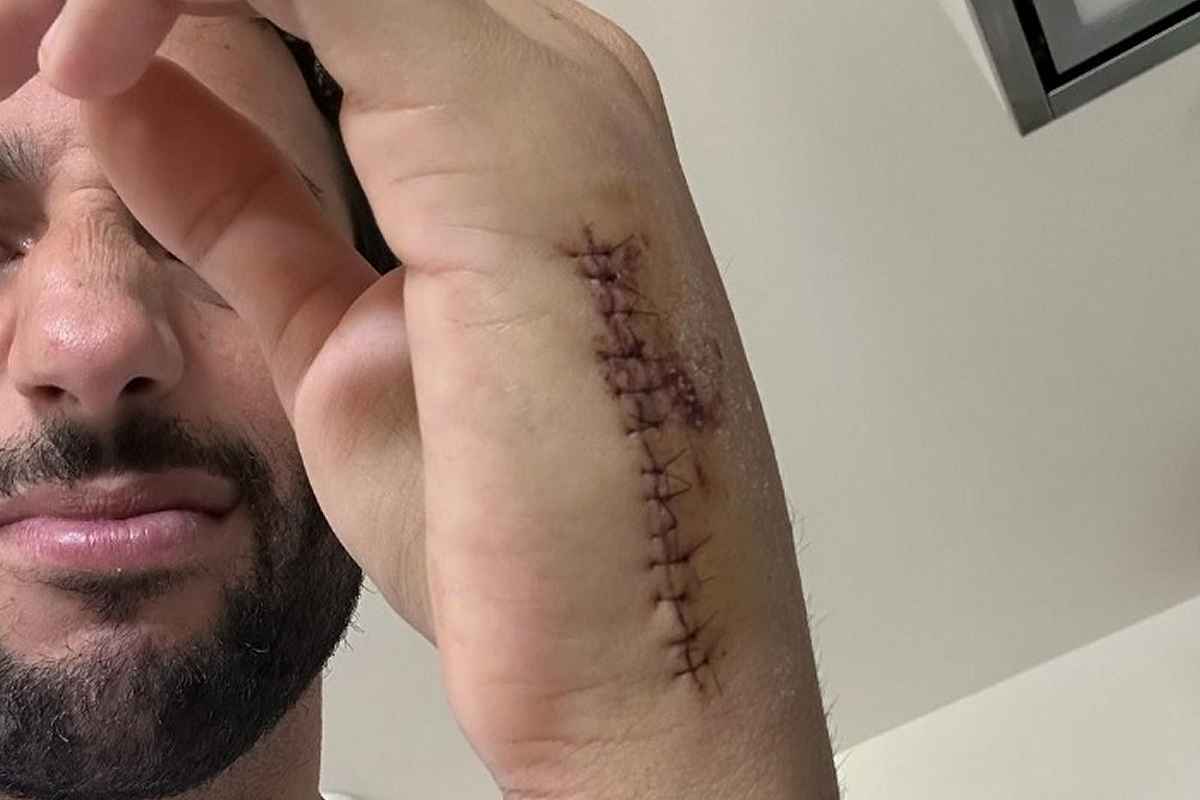 ダニエル・リカルドの骨折は「7か所」　復帰は早くても来月のF1カタールGPか